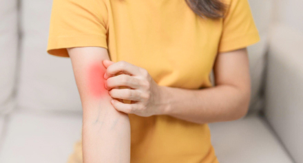 Image representing Lupus Uncovered: A Comprehensive Guide to the Autoimmune Disease
