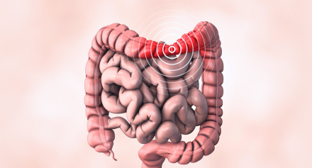 Image representing Irritable Bowel Syndrome: Causes and Management Strategies