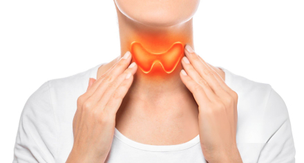 Image representing Understanding Hypothyroidism – Causes, Symptoms and Effective Management